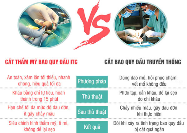 So sánh 2 phương pháp cắt bao quy đầu