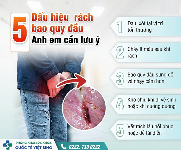 Rách bao quy đầu: Cẩn trọng với những nguyên nhân này